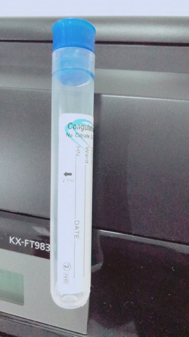 ทิ้วส์ใส่เลือด Fushino Citrate for Coag 2.7ml.13x75mm (1000/pack)